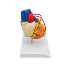 Herzmodell mit Bypassgef&auml;&szlig;en
