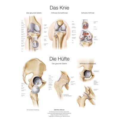 Lehrtafel "Das Knie und die Hüfte", 70 x 100 cm