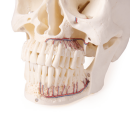 Schädelmodell für Zahnmedizin und Kieferchirurgie, 5-teilig