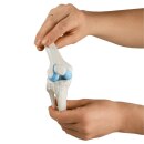 Erler-Zimmer Knie-Implantat-Modell, 3 Teile