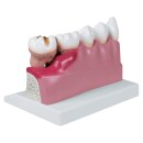 Erler-Zimmer Dentalmodell, 4-fach vergrößert