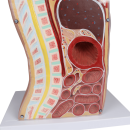 Erler-Zimmer NG & Tracheostomie Torso, lebensgroß