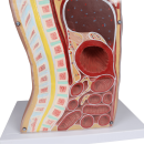 Erler-Zimmer NG &amp; Tracheostomie Torso, lebensgro&szlig;