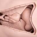 3B Scientific Pflegepuppe PRO