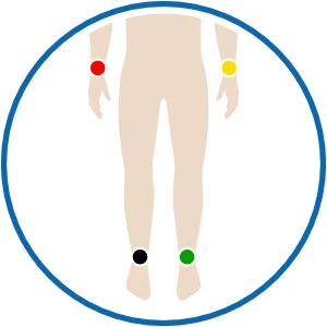 EKG Elektroden Ampel System Platzierung