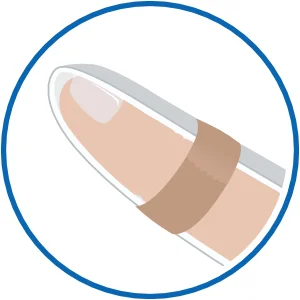 Alu Fingerschiene schematisch dargestellt