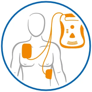Grafik: Defibrillator-Anwendung-defi-pads