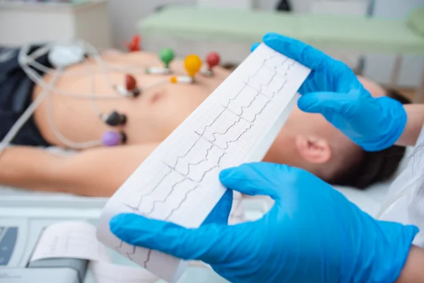 EKG-Elektroden-kleben_Foto1_BildvonSalovEvgeniyShutterstock.webp
